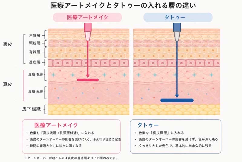 アートメイクの目的